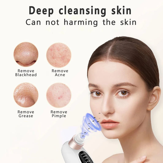 Pore Vacuum Cleaner Blackhead Remover